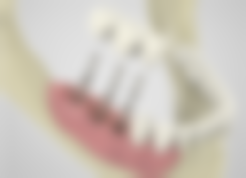 刘忠研医生项目收费价格