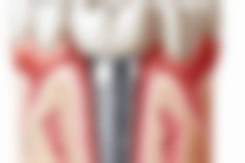 新泰美润口腔（青云小镇店）预约挂号方式