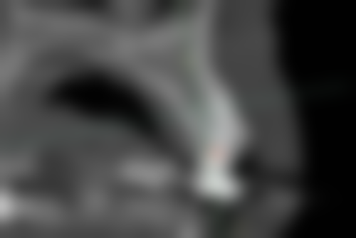 山东潍坊诸城清德口腔收费价格表