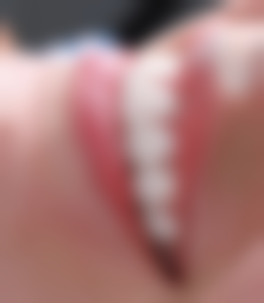 河南洛阳高士洁口腔收费价格表