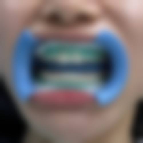 邯郸肥乡佳洁口腔预约挂号方式