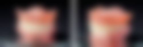 闫绍华医生技术优势