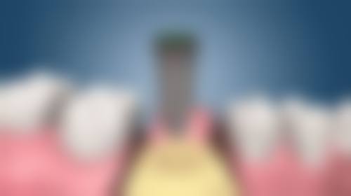 闫绍华医生项目收费价格