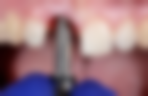 江苏无锡佰乐口腔医生团队介绍