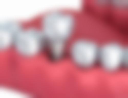 陕西榆林灵星口腔预约挂号方式