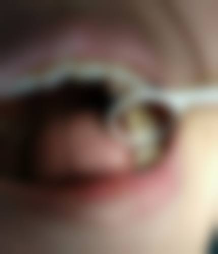 江苏宿迁泗洪县百姓口腔预约挂号方式