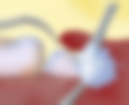 李良红医生项目收费价格