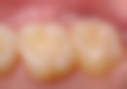 江苏苏州维尔口腔特色诊疗项目与技术优势