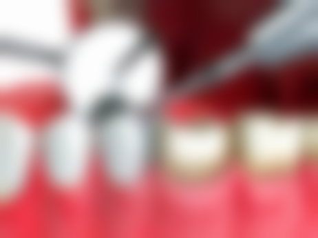 深圳大学附属华南医院袁婷婷医生口碑评价及反馈内容