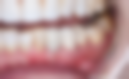 深圳千喜口腔门诊部(布吉店)预约挂号方式