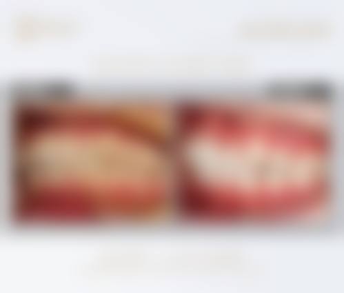 李力医生项目收费价格