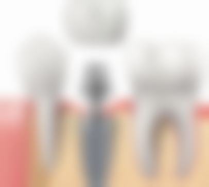 石家庄市第五医院口腔科预约挂号方式