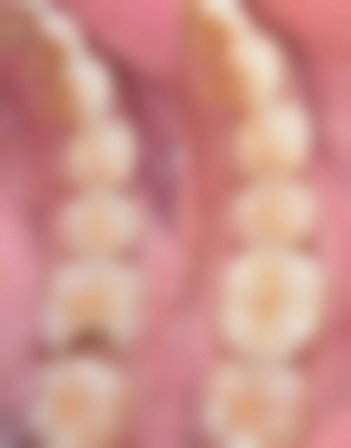 武汉大众口腔(雄楚一号店)预约挂号方式