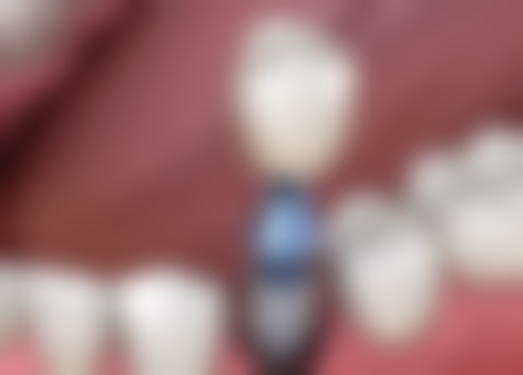 刘建阳医生执医荣誉