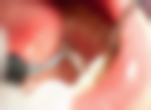 高圣檬医生口碑评价及反馈内容