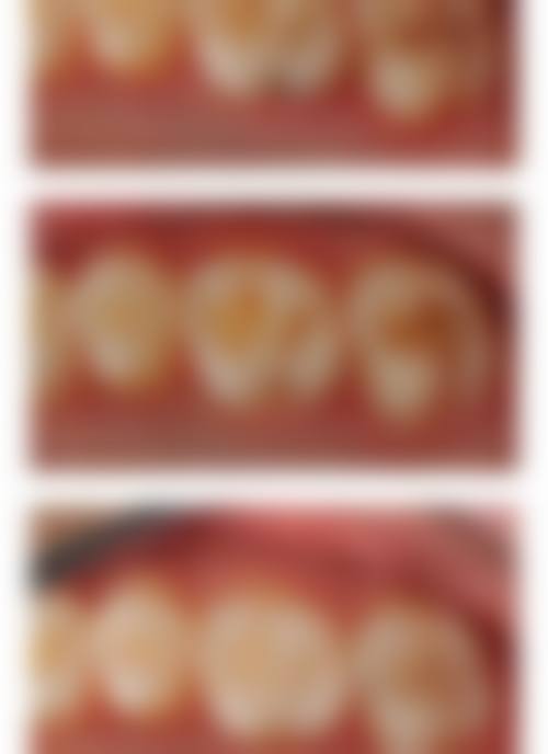 南昌大学第一附属医院口腔科预约挂号方式