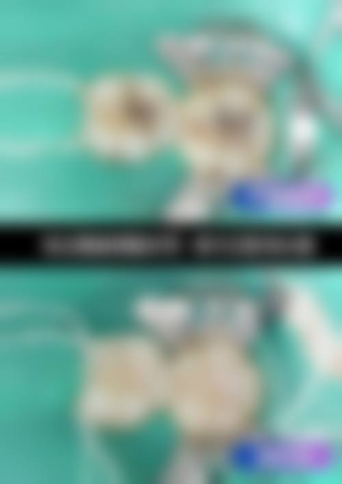 武汉固美口腔门诊部收费价格表