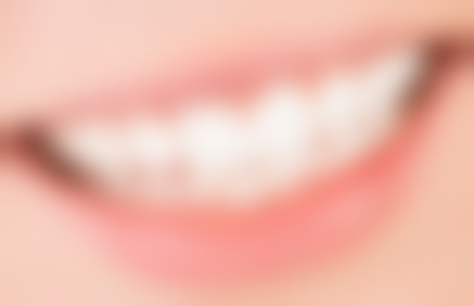 周姿君医生技术优势