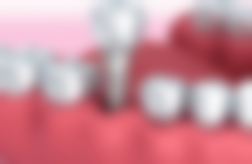 航天中 心医院口腔科特色诊疗项目与技术优势