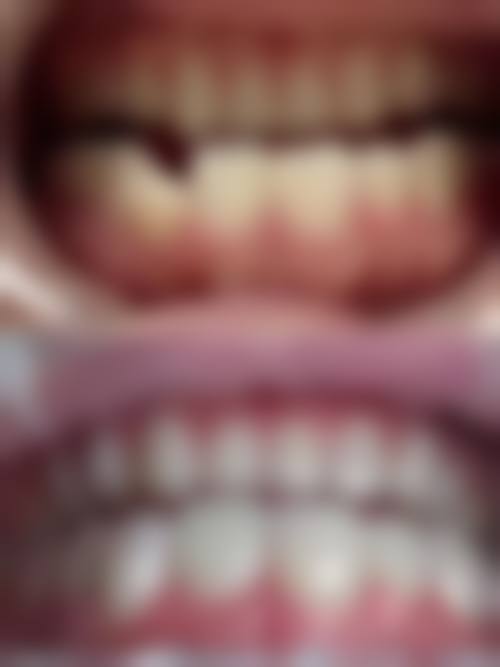 张广涛医生技术优势