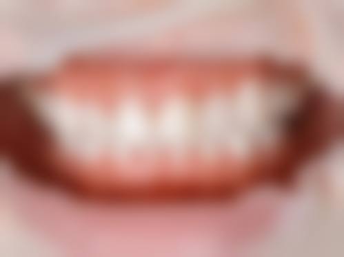 常旭峰医生项目收费价格