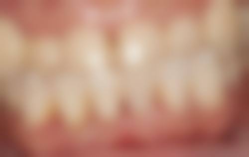 广东汕尾陆丰林海洲口腔诊所预约挂号方式