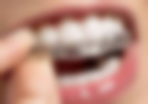 深圳一芽口腔诊所特色诊疗项目与技术优势