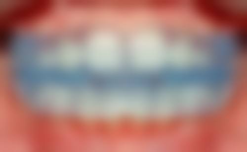 新泰李慎凤口腔诊所收费价格表