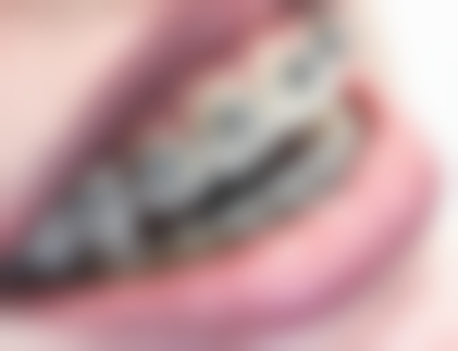 峡一生口腔医院收费价格表