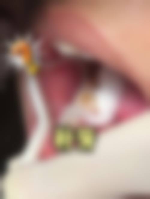 西安兔博士口腔医院收费价格表