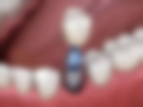 江门梁小虎口腔诊所医生团队介绍
