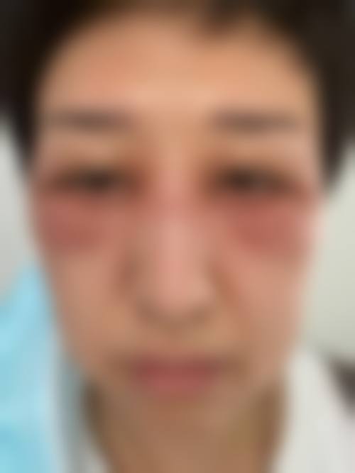 临床实例分享