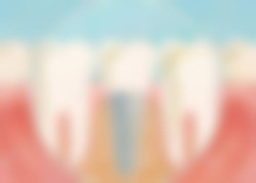 临床实例分享