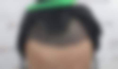 临床实例分享