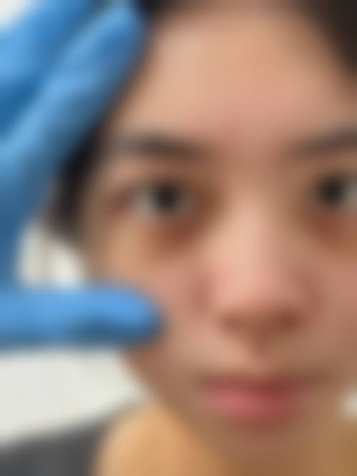 擅长项目详解