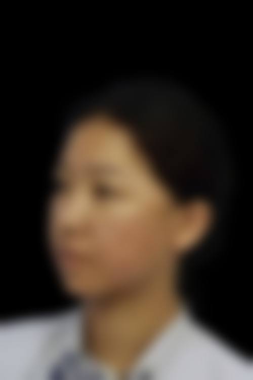 临床实例分享