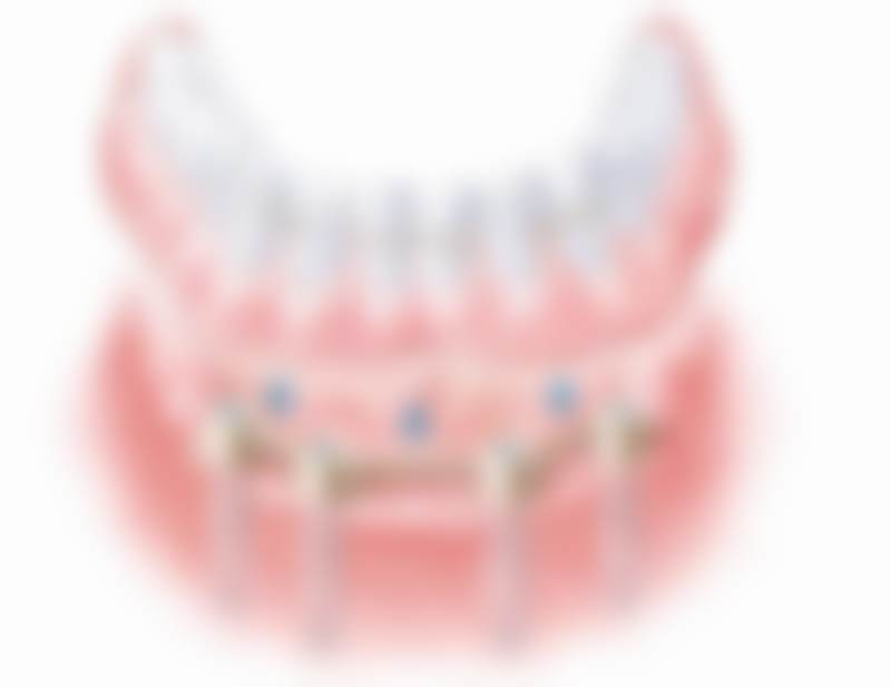 南京卡瓦口腔特色诊疗项目与技术优势