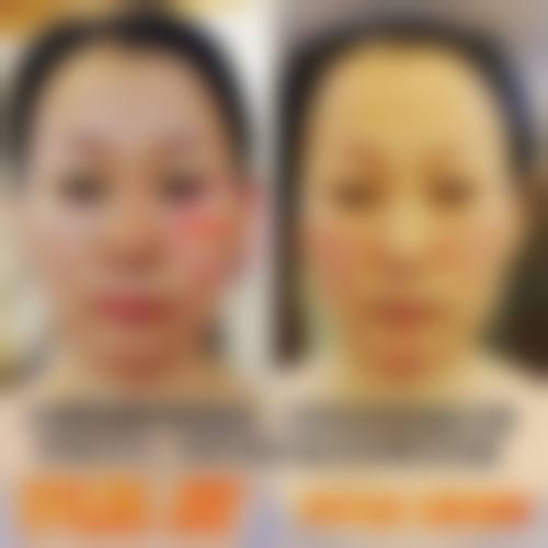 优惠活动详情:限时特别优惠,到院即享
