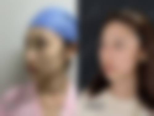 患者真实评价:找王露萍医生做过项目的人怎么说?
