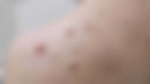 预约优惠活动:如何预约王露萍医生并享受专属优惠?