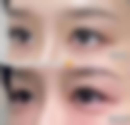 擅长项目详解:王露萍医生擅长做我需要的项目吗?