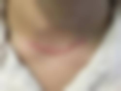 临床实例分享