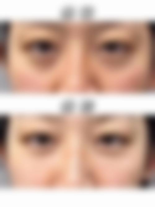 临床实例分享