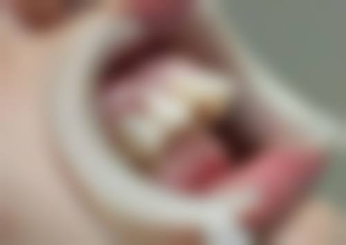 严凤医生口碑评价及反馈内容