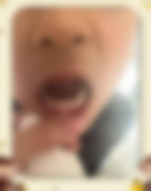 殷强医生口碑评价及反馈内容