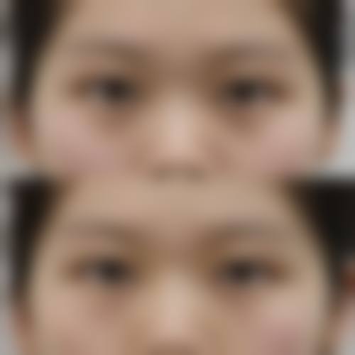 优惠活动详情:热玛吉项目限时特别优惠,原价29800元-优惠价19800元