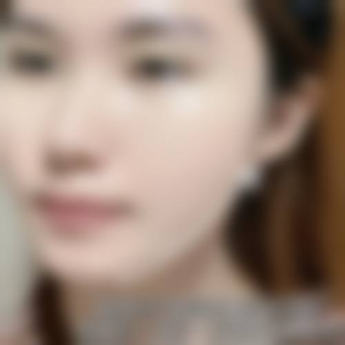 总结——选择正规机构,放心变得更美
