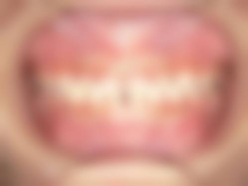 常见问题解答