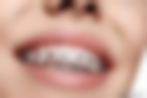 预约优惠活动