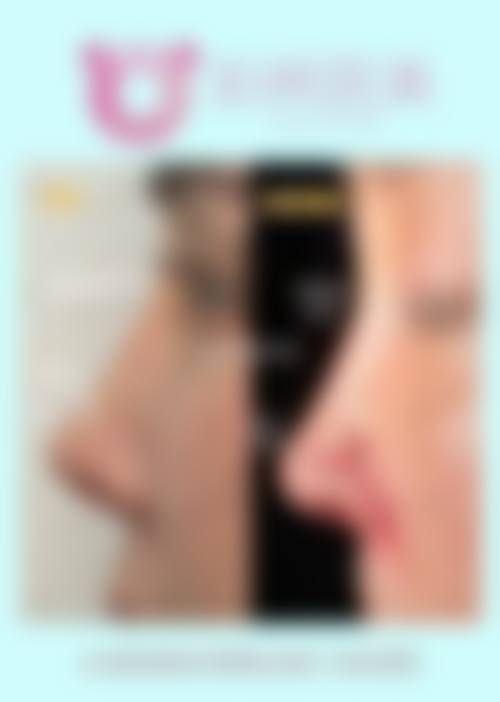 优惠活动详情:限时特别优惠助力美丽蜕变